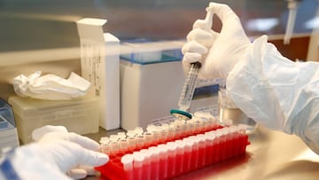 FILE PHOTO: A scientist filters out samples during the research and development of a vaccine against the coronavirus disease (COVID-19) at a laboratory of BIOCAD biotechnology company in St Petersburg, Russia June 11, 2020. REUTERS/Anton Vaganov/File Phot