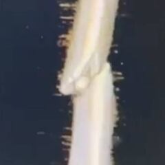 Márquez muestra los doce clavos que lleva en el brazo