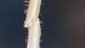 Márquez muestra los doce clavos que lleva en el brazo