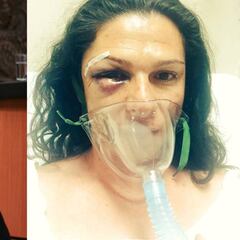 Ana Guevara, hospitalizada tras una brutal agresión en México