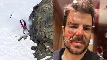 Aymar Navarro se recupera de sus heridas tras caida Verbier