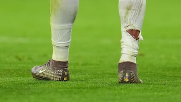 MADRID, SPAIN - APRIL 07: A detailed view of Kylian Mbappe of Real Madrid ripped sock after a tackle during the UEFA Champions League 2025/26 Quarter-Final First Leg match between Real Madrid CF and FC Bayern München at Estadio Santiago Bernabeu on April 07, 2026 in Madrid, Spain. (Photo by Aitor Alcalde/Getty Images)