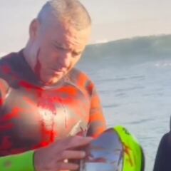 Los cascos de surf, a debate por una herida en la cara de Garrett McNamara