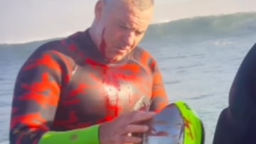 Garrett McNamara con una herida en la cara, mirando su casco de surf en Nazaré, Portugal, en noviembre del 2022.