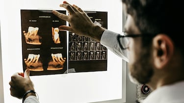 Los mejores cursos online de tcnico en imagen para el diagnstico