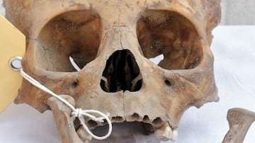 The skull of a child, which presents Cribra Orbitalia (a disease associated with malnutrition), part of the burial of four infants dating from 1521 to 1620, but which were still buried in the pre-Hispanic style and discovered by researchers of the National Institute of Anthropology and History (INAH) in downtown Mexico City, Mexico, is pictured in this handout distributed to Reuters on June 27, 2022. Juan Carlos Campos Varela/INAH - National Institute of Anthropology and History/Handout via REUTERS ATTENTION EDITORS - THIS IMAGE WAS PROVIDED BY A THIRD PARTY. NO RESALES. NO ARCHIVES