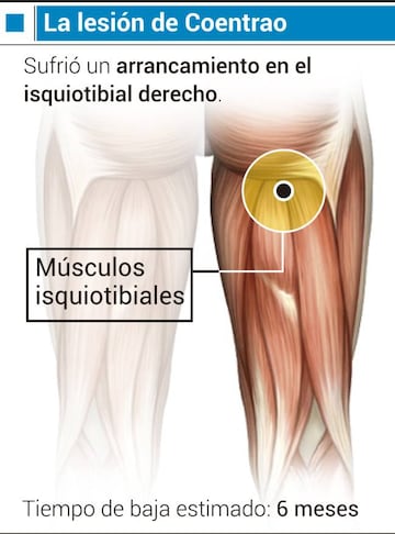 La lesión de Coentrao.