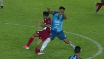 La espantosa patada que sufrió un ex Huachipato en Bolivia