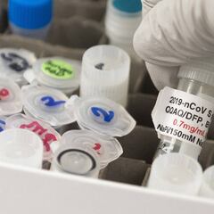 Vacuna Coronavirus: ¿Qué diferencia hay entre células T y anticuerpos?