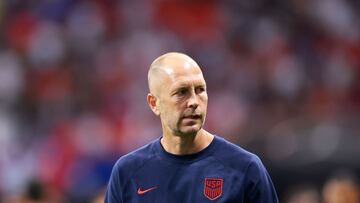Ante la situaci¨®n de Estados Unidos, donde disputar¨¢n su boleto a cuartos de final de Copa Am¨¦rica frente a Uruguay, Lalas se pronuncia.