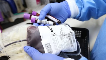 Hasta qu&eacute; edad se puede donar sangre: requisitos, riesgos y cu&aacute;ntas veces se puede donar al a&ntilde;o.