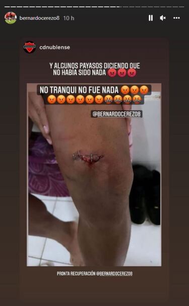 ¡Impactante! Bernardo Cerezo mostró su herida tras el partido