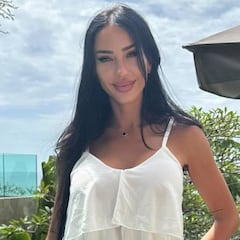 Aurah Ruiz muestra el resultado de su último retoque estético: “Adiós relleno”