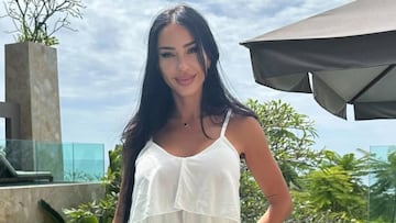 Aurah Ruiz muestra el resultado de su último retoque estético: “Adiós relleno”