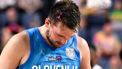 Cologne (Germany), 07/09/2022.- Luka Doncic of Slovenia reacts after picking up an injury during the FIBA EuroBasket 2022 group B stage match between France and Slovenia in Cologne, Germany, 07 September 2022. (Baloncesto, Francia, Alemania, Eslovenia, Colonia) EFE/EPA/SASCHA STEINBACH
