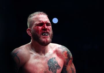 El BKB (Bare-knuckle boxing) es el deporte del boxeo sin el uso de guantes de boxeo u otro acolchado en las manos de los participantes.