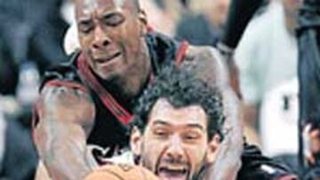 <b>PUNTOS DE SUTURA. </b>Garbajosa peleó un rebote con Hunter y tuvo que recibir puntos.