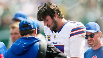 The NFL’s reigning MVP got battered in the Buffalo Bills game against the New York Jets on Sunday, and he’s got the battle wounds to prove it.