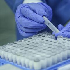 Liga BetPlay 2021: ¿cómo es el protocolo en caso de positivo por coronavirus en un equipo?