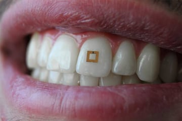 El sensor o wearable dental que se conecta al móvil
