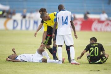 El mediocampista hondureño sufrió una impactante lesión, luego de que Javier Aquino le cayó encima de la pierna en una jugada sin intención en el duelo de Concacaf.





