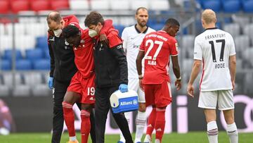 La estrella canadiense del Bayern M&uacute;nich tuvo que dejar el terreno de juego a los 2 minutos contra el Frankfurt por una lesi&oacute;n que parece grave.