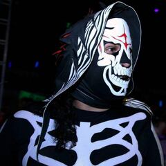 La Parka ya fue operada y se encuentra en recuperación