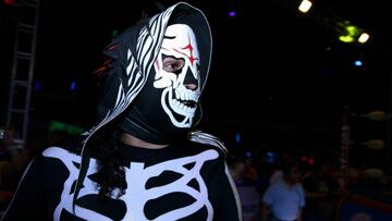 La Parka ya fue operada y se encuentra en recuperación