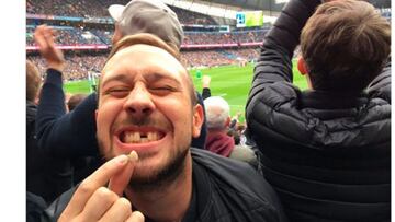Un aficionado del United se deja los dientes por su equipo