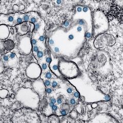 El CSIC descubre un nanomaterial que elimina el coronavirus