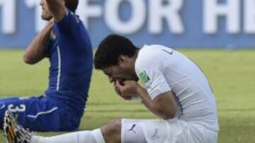 Luis Suárez se toca la dentadura tras morder a Chiellini en el pasado Mundial