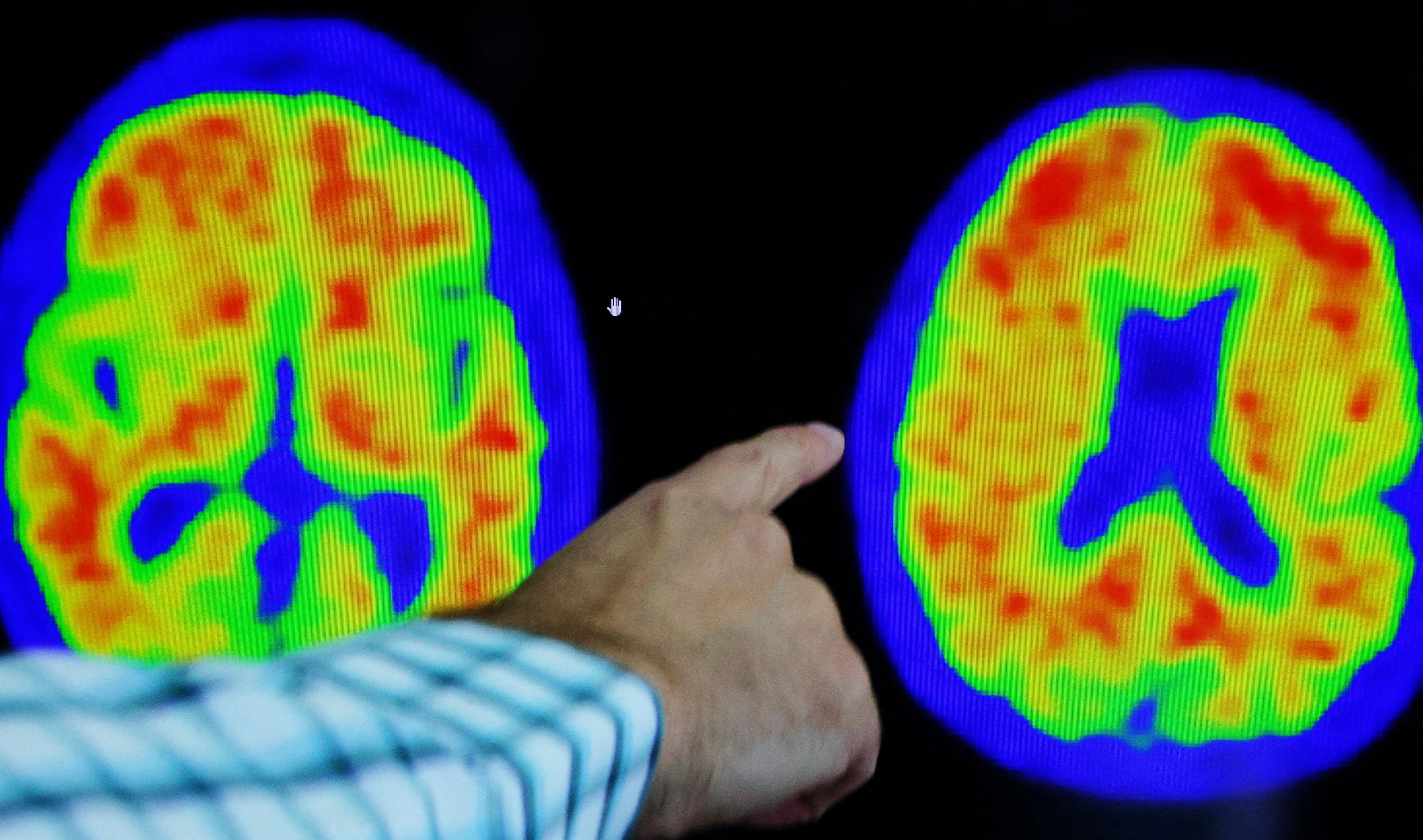 If you notice this mental change in your 40s, psychology says you should pay close attention
