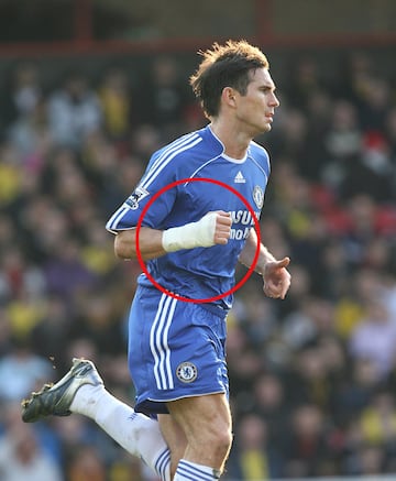 El jugador del Chelsea lució un vendaje en su mano derecha durante el partido de la FA Premiership frente al Watford en 2008.