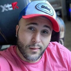 Preocupación por el estado de salud de Kiko Rivera: "A quirófano, deseadme suerte"