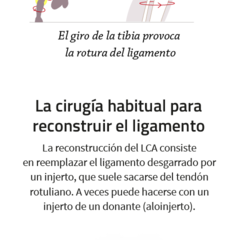 ¿Por qué se rompe el ligamento cruzado? Este gráfico lo explica
