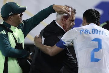 Mexico's coach, Javier Aguirre, is helped by an assistant and Honduras' defender #02 Denil Maldonado after being injured in the head when he was hit by an object thrown from the bleachers at the end of the National League of Concacaf quarterfinal first leg match between Honduras and Mexico at the Francisco Morazan stadium in San Pedro Sula, Honduras, on November 15, 2024. (Photo by Jhony MAGALLANES / AFP)