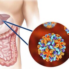 Día Mundial contra la Hepatitis: diferencias entre la A, B y C