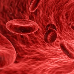 Golpe al colesterol: la novedosa técnica que limpia las arterias