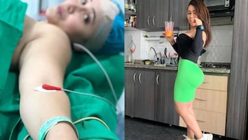 Las cirugías de Yina Calderón y Manuela Gómez