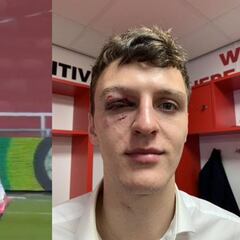 A un centímetro de perder el ojo