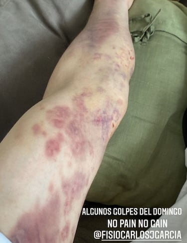 "Marc está solucionando los problemas con el tren delantero"