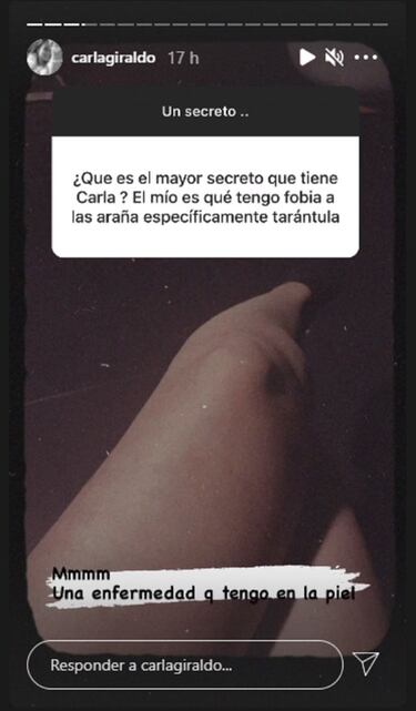 Carla Giraldo habla de su enfermedad en la piel