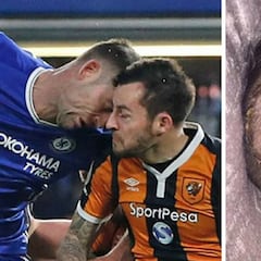 Este cabezazo con Cahill provoca la retirada de Mason, del Hull City, con 26 años
