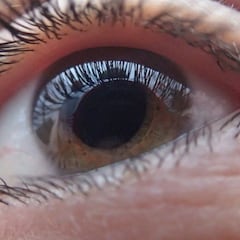 El nuevo síntoma de la COVID persistente: cambios en la córnea de los ojos