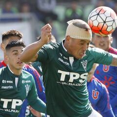 Javier Parraguez debe entrenar con corchetes en la cabeza