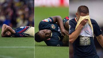 Los tres jugadores quedarían descartados para el encuentro de este sábado en tierras michoacanas luego de salir por lesión ante Tigres.