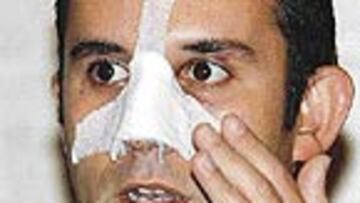 <B>DOLORIDO</b>. El aspecto del rostro de Antonio mostraba las consecuencias de la paliza que recibió.