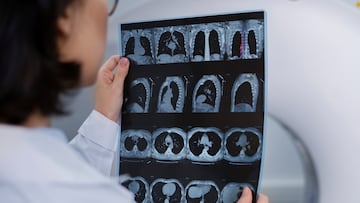 Young adults are more susceptible than their parents to gastrointestinal cancers, a new study has revealed.