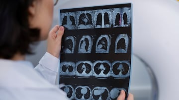 Diagnostican a una mujer de 72 años cáncer de próstata, le horroriza leer los resultados y acude al médico inmediatamente