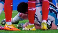 Messi termina sangrando por esta falta salvaje: ojo a lo que dice el relator